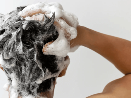 Minoxidil foam vs lotion - Two hair loss remedies compared