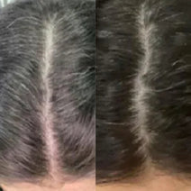 Neofollics anti-grey hair tablets Neofollics anti-grey hair tablets - Hair Growth Specialist