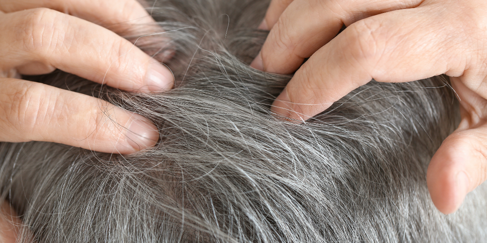 Dilemmat med grått hår: Kan vi förhindra det?