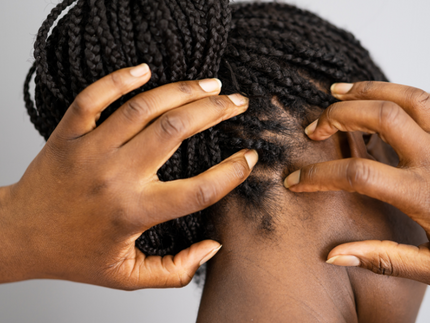 Öm hårbotten: Allt du behöver veta om inflammation i hårbotten