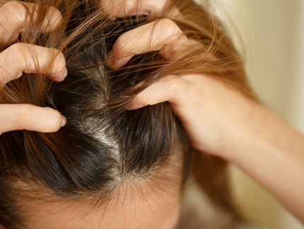 What to do about scabs on your scalp?