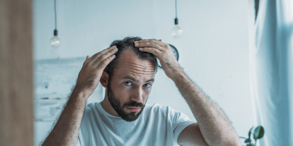 The Norwood scale: A guide to male pattern baldness