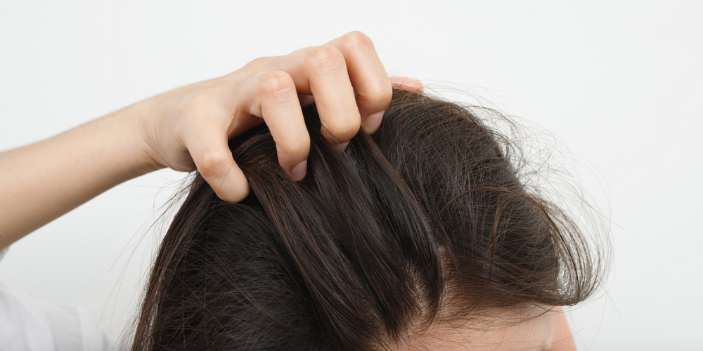 Suffering from psoriasis on your scalp? Discover the causes and solutions