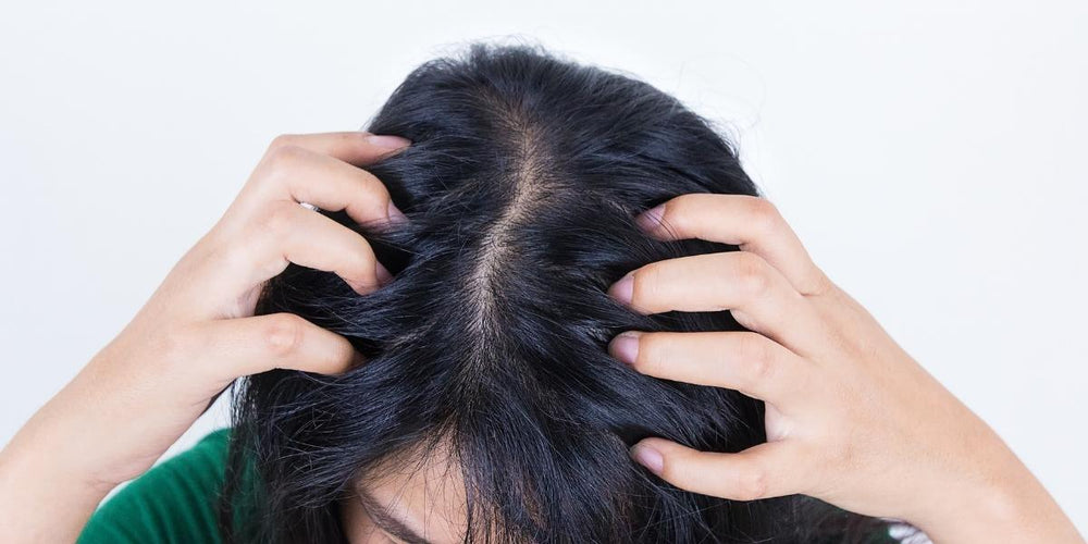 Consejos para combatir el picor del cuero cabelludo