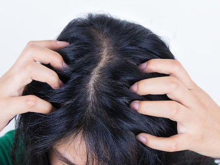 Advice for when dealing with an itchy scalp