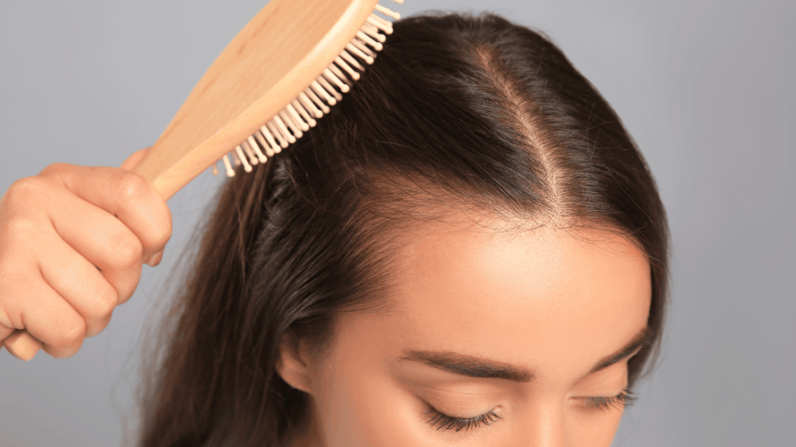 Receding hairline in women: Causes and treatment options