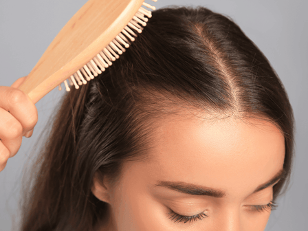 Recessione dei capelli nelle donne: Cause e opzioni di trattamento
