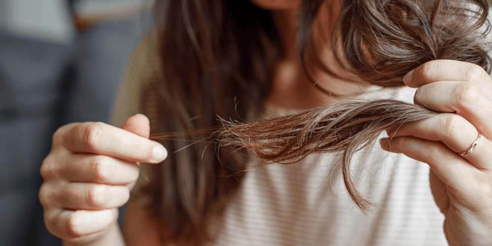Caída repentina y grave del cabello en las mujeres