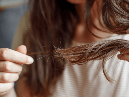 Perdita improvvisa e grave di capelli nelle donne