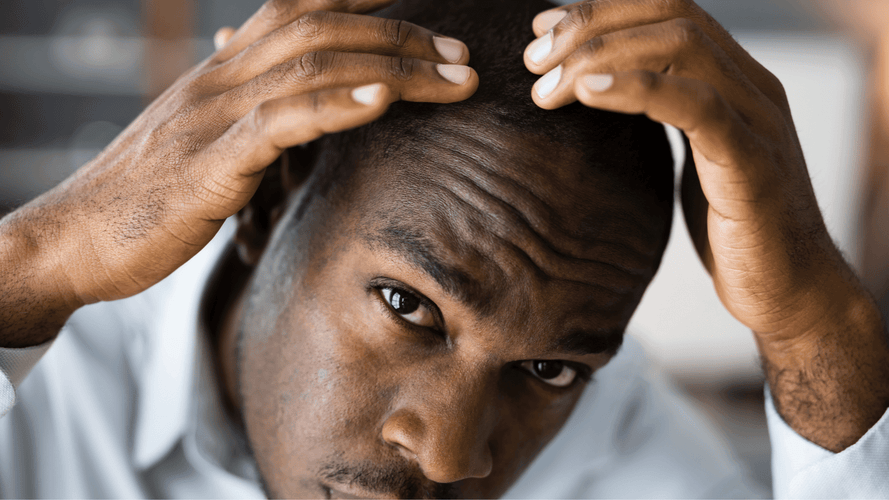 Effet du kétoconazole et de la piroctone olamine sur la croissance des cheveux