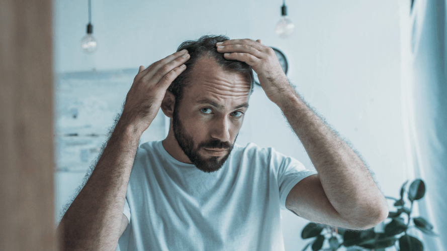 Tipi di perdita di capelli