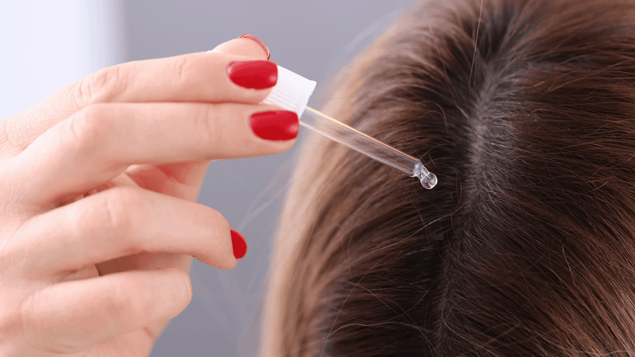 When and how to use a lotion against hair loss