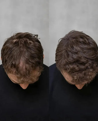 3x fibre per capelli Keratain + pomata Keratain in omaggio