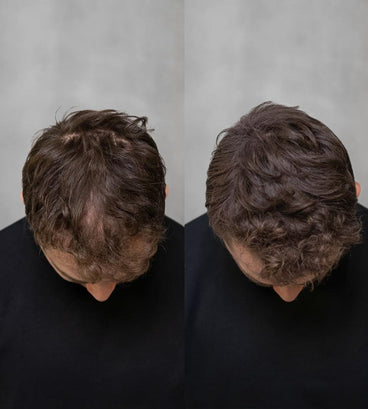 3x Keratain hair fibers + free Keratain pomade – Dark blonde (25 gr) - Hair Growth Specialist