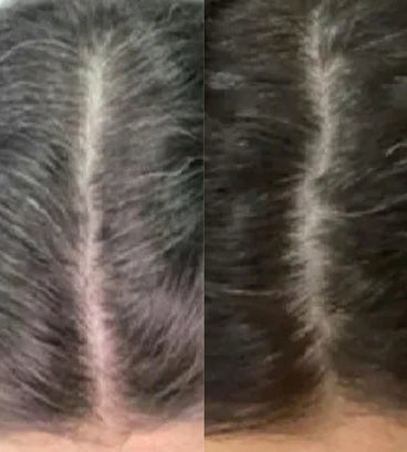 Neofollics anti-grey hair tablets