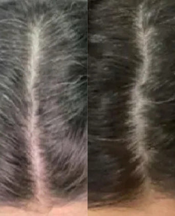 Neofollics anti-grey hair tablets (3-pack) - Hair Growth Specialist