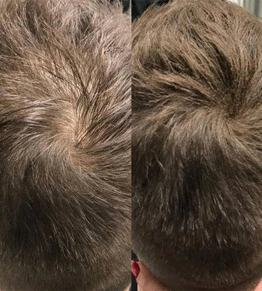 Beaver keratin hårbyggande fibrer - Ljusbrun (28 gr)