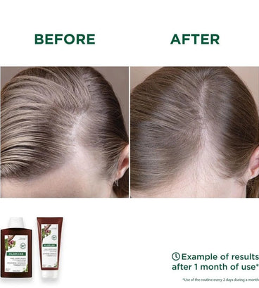 Klorane anti-hair loss conditioner Quinine/Edelweiss (200 ml) - Hair Growth Specialist