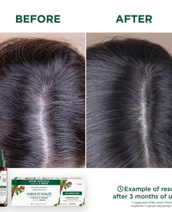 Klorane anti-hair loss serum Quinine/Edelweiss (100 ml) - Hair Growth Specialist
