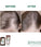 Klorane anti-hair loss shampoo Quinine/Edelweiss (200 ml) - Hair Growth Specialist