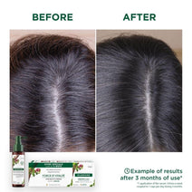 Klorane anti-hair loss treatment - Hair Growth Specialist