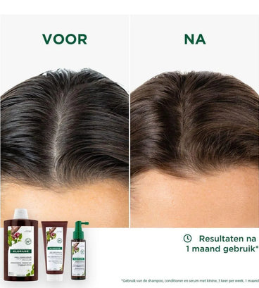 Klorane anti-hair loss treatment - Hair Growth Specialist