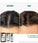 Klorane anti-hair loss treatment - Hair Growth Specialist