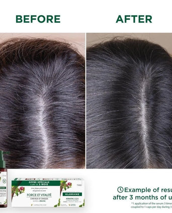 Klorane KeratinCaps (3 x 30 capsules) - Hair Growth Specialist