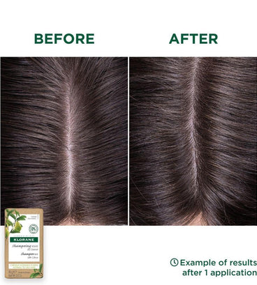 Klorane shampoo bar Citrus - oily hair (80 gr) - Hair Growth Specialist