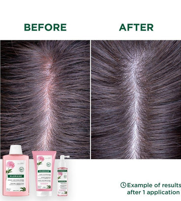 Klorane shampoo Peony - sensitive scalp (400 ml) - Hair Growth Specialist
