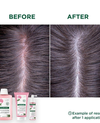 Klorane SOS serum sensitive scalp Peony (100 ml) - Hair Growth Specialist