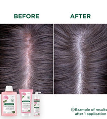 Klorane treatment for sensitive scalp - Hair Growth Specialist