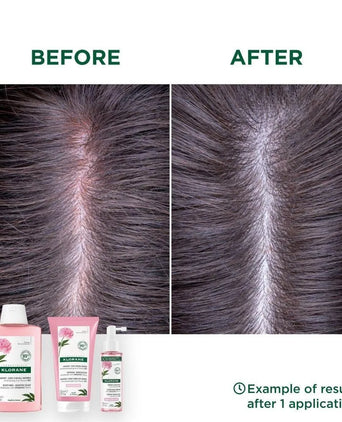 Klorane treatment for sensitive scalp - Hair Growth Specialist