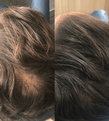 Revita shampoo (925 ml) - Hair Growth Specialist
