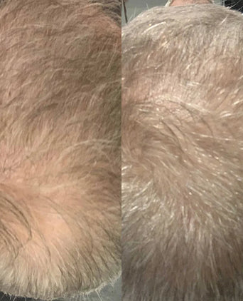 Trattamento Scandinavian Biolabs per la crescita dei capelli (uomini)